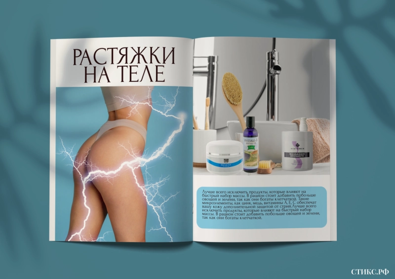 Откуда появляются растяжки на коже и как их убрать